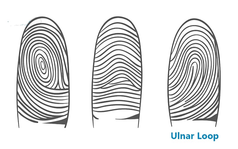 Vân tay UL có 1 tâm và 1 detal  là vân có những đường vân đổ về ngược với detal như một dòng nước hướng về phía ngón út