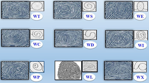 Chủng vân tay này có các chủng con viết tắt là WT, WS, WE, WI, WD, WC, WP, WL, WX