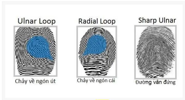 Chủng vân tay SUL là dạng đường vân đứng