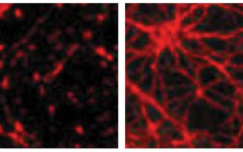 Hình ảnh biểu thị sự tác động của NGF đối với các tế bào nãoHình trái: Các tế bào não thưa thớt do thiếu sự tác động của NGF Hình phải: Các tế bào não phát triển mạnh mẽ nhờ sự hiện diện của NGF
