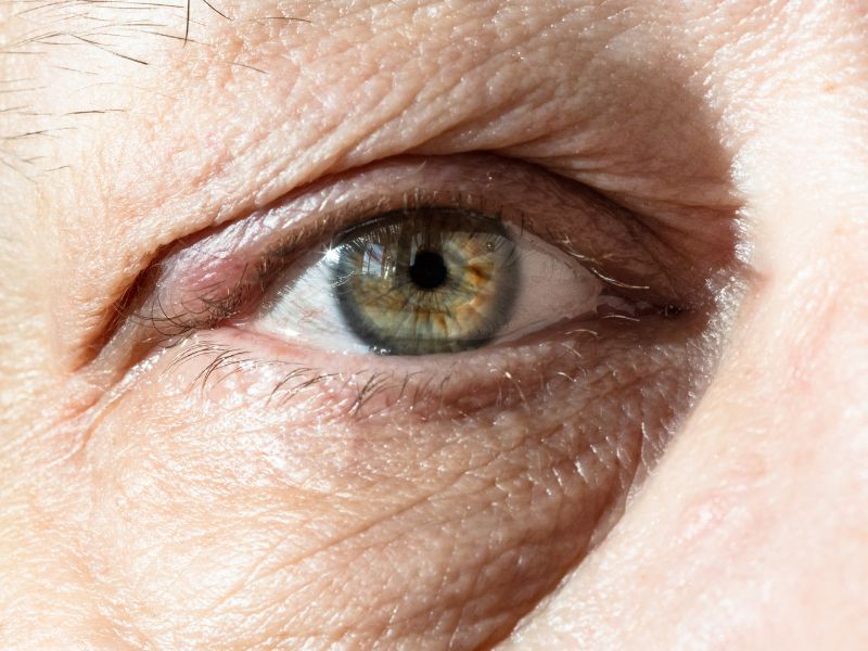 Sinh trắc học là gì? TẤT TẦN TẬT thông tin về sinh trắc học 7 Thông qua các loại camera phù hợp sẽ thấy được tĩnh mạch củng mạc mắt