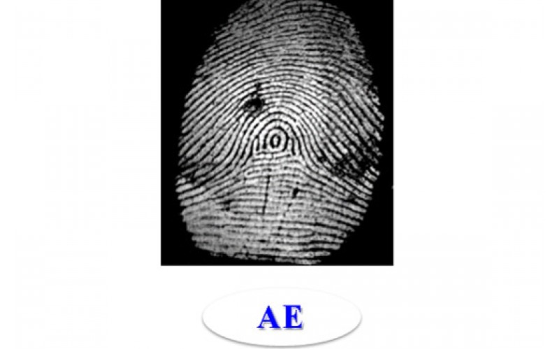 Vân tay AE có 1 tâm và 2 Detal bên ngoài, nhìn kỹ ta sẽ thấy vân tay AE có 1 Tâm tròn ở giữa và khoảng cách từ tâm đến delta không quá 5 đường vân