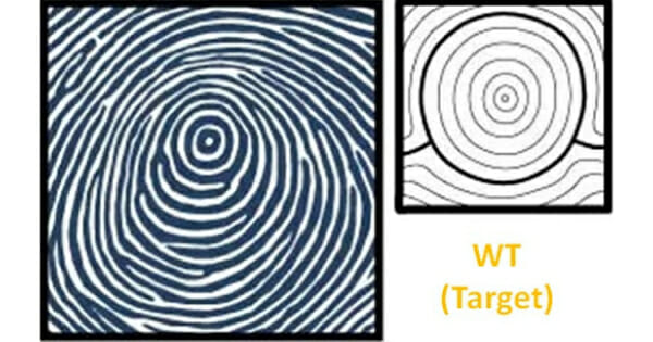 Chủng vân tay WT là viết tắt của "Whorl Tented”