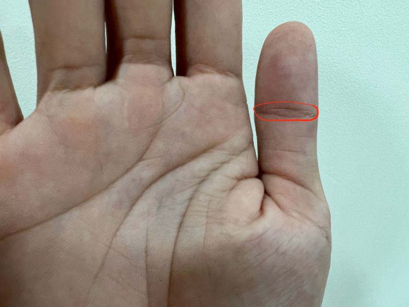 vân tay mắt phượng